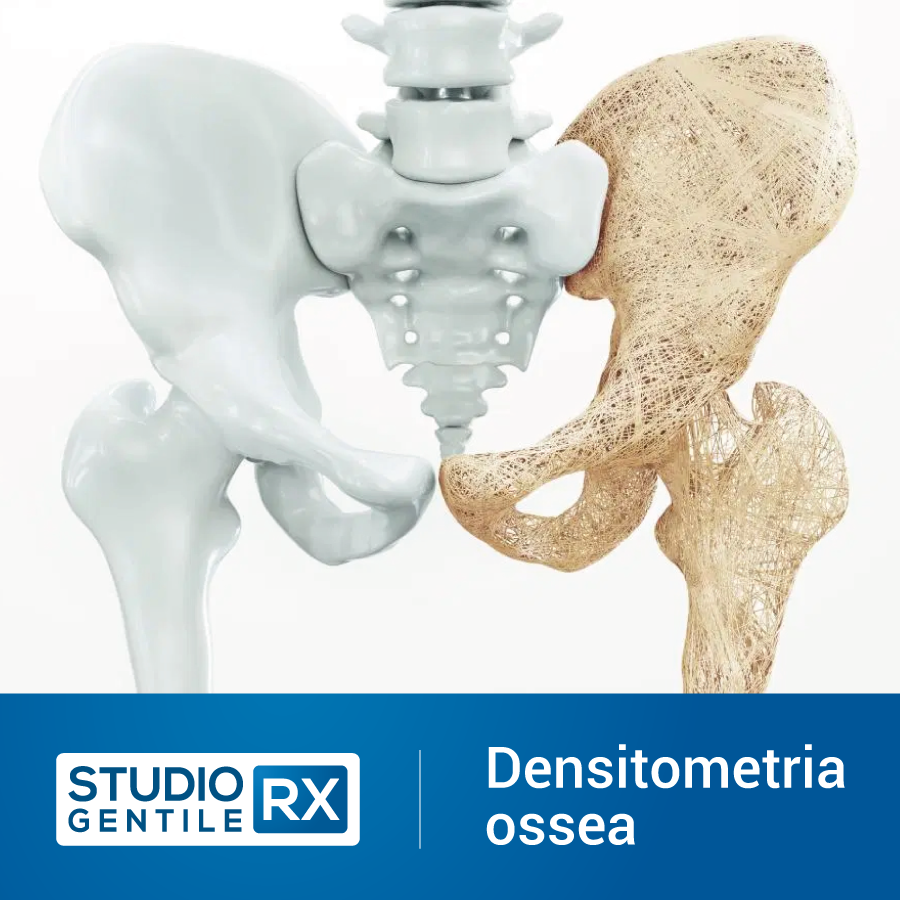 Densitometria Ossea a Bagheria - Palermo presso Studio RX Gentile · Studio di radiologia a Bagheria