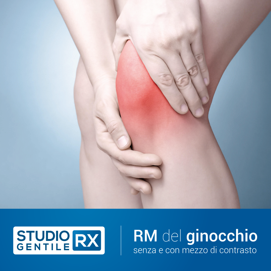 Risonanza magnetica del ginocchio senza e con mezzo di constrasto (RM ginocchio) presso Studio RX Gentile · Studio Radiologico a Bagheria, Palermo