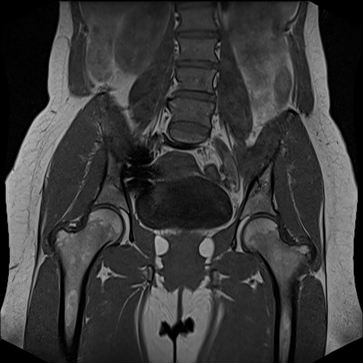 Risonanza magnetica dell'anca senza e con mezzo di contrasto (RM anca) presso Studio RX Gentile · Studio di radiologia a Bagheria