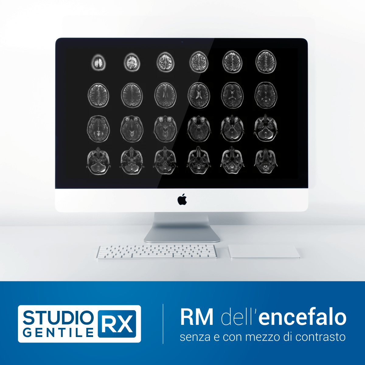 Risonanza magnetica del cervello e del tronco encefalico senza e con mezzo di contrasto (RM encefalo) presso Studio RX Gentile · Studio Radiologico a Bagheria, Palermo