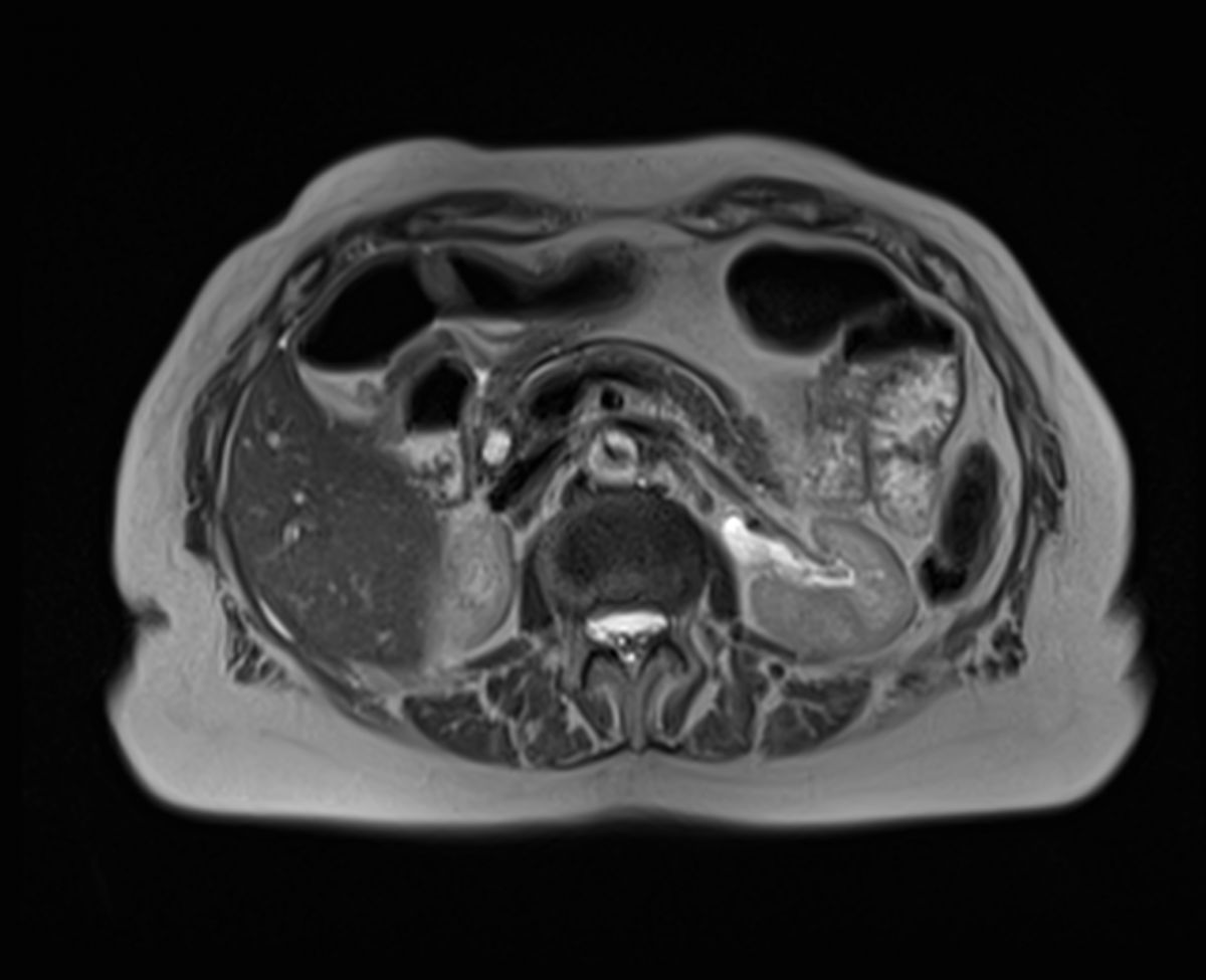 Colangio Risonanza magnetica a Palermo (Bagheria) presso Studio RX Gentile · Studio di radiologia a Bagheria