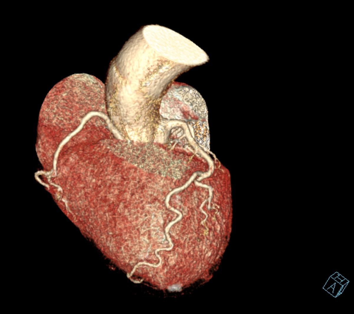 Nuova TC Siemens go. Top presso Studio RX Gentile · Studio di radiologia a Bagheria