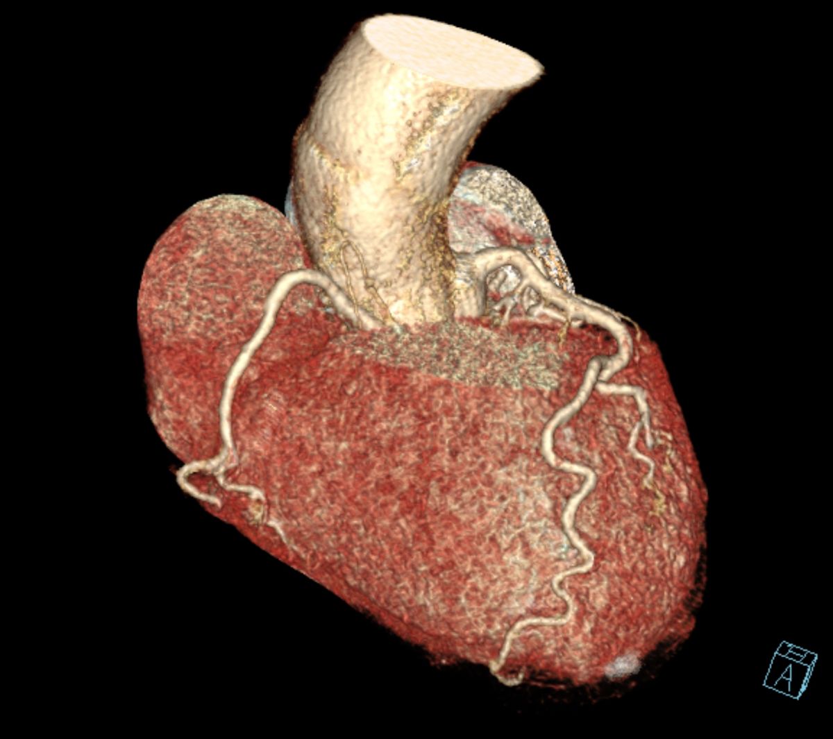 Cardio TC a Palermo - Bagheria presso Studio RX Gentile · Studio di radiologia a Bagheria