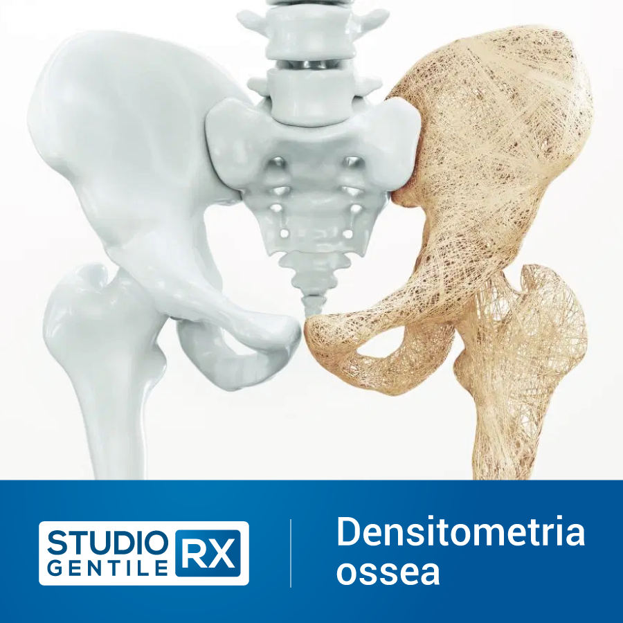Densitometria Ossea (MOC) presso Studio RX Gentile · Studio Radiologico a Bagheria, Palermo