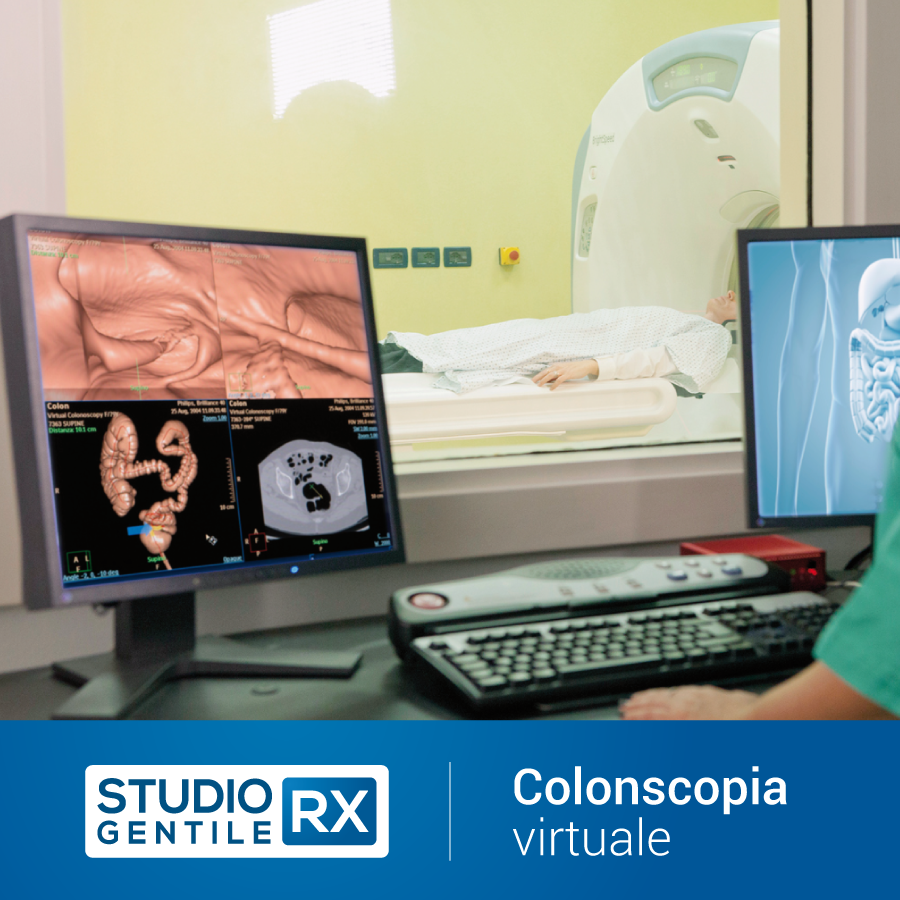 Colonscopia Virtuale a Palermo - Bagheria presso Studio RX Gentile · Studio di radiologia a Bagheria