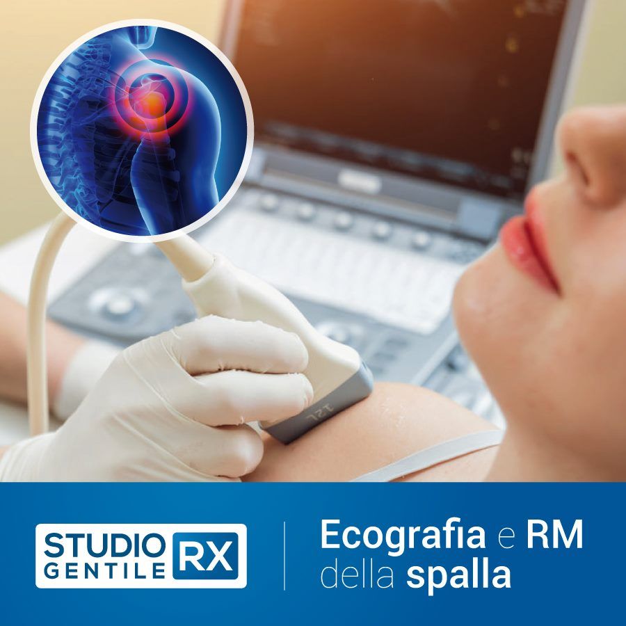 Risonanza magnetica della spalla senza e con mezzo di contrasto (RM spalla) presso Studio RX Gentile · Studio Radiologico a Bagheria, Palermo