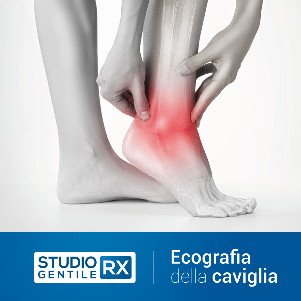 Ecografia della caviglia presso Studio RX Gentile · Studio Radiologico a Bagheria, Palermo